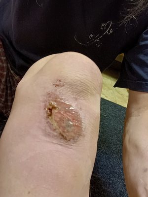 Abbott Northwestern Hospital by null