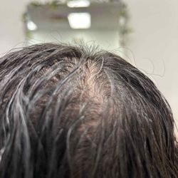Rudy & Kelly Academy - It looks like I'm losing my hair. That's how bad the breakage is