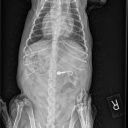 Fish hook in stomach