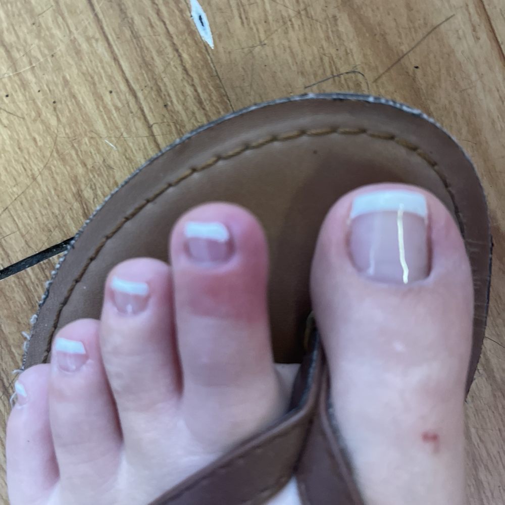 Aroma Nails - Infection - Nail Salons Near Me - Maple Valley, Washington Aroma Nails - Infection - Nail Salons Near Me - Maple Valley, Washington