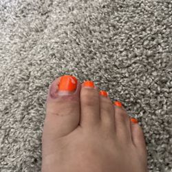 Luxury Top Nails & Spa - Swollen from the cut ingrown they are bad at it!!! Never go there again!!