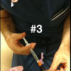 Arrowhead Orthopaedics - Redlands - Knee injection