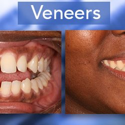 Carolina Forest Cosmetic Dentistry