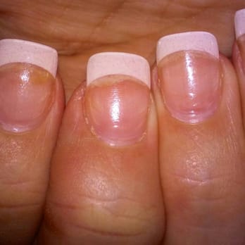 Pro Nails - Bad Fill - Nail Salons Near Me - Boynton Beach, Florida Pro Nails - Bad Fill - Nail Salons Near Me - Boynton Beach, Florida