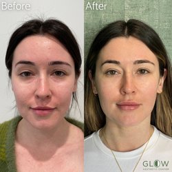 Glow Aesthetic Center