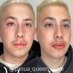 Glam Queen Beautique - Paramedical lip blushing, used to camouflage a birthmark. Not all lip blushing is for makeup purposes.
