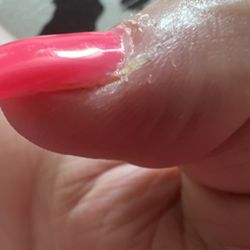 K C Nails - Uneven nail