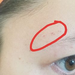 Asian Eyebrow Threading - 5 similar sized cuts in a row