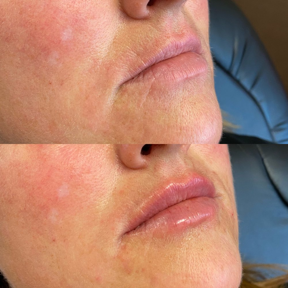 LASER & SKIN CARE CENTER Updated August 2024 19 Photos 1613