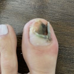 Red Nail