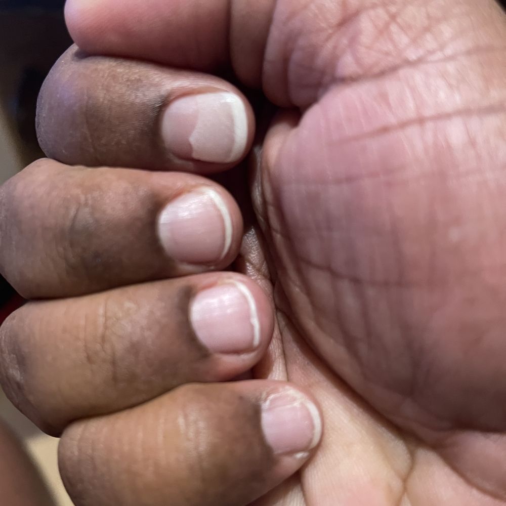 LE VERNIS - 14 days: The powder nails started breaking off. My nails are paper thin and damaged. - Nail Salons Near Me - Beverly, Massachusetts LE VERNIS - 14 days: The powder nails started breaking off. My nails are paper thin and damaged. - Nail Salons Near Me - Beverly, Massachusetts