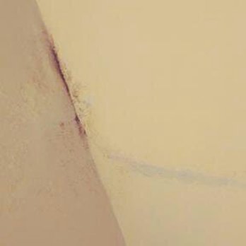 Advent Properties - the bathroom ceiling ready to cave in. loaded with water behind the paint. - Property Management Near Me - Oakland, California Advent Properties - the bathroom ceiling ready to cave in. loaded with water behind the paint. - Property Management Near Me - Oakland, California