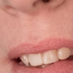 Domenella David, DDS - The worst dentist I've ever seen. Do not go there