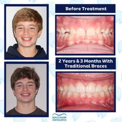 North Shore Pediatric Dental Associates