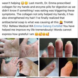Renew Medical: Emma Doody, ND - Dermatitis resolved!