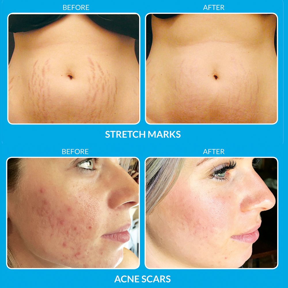 SkinHappy Logo