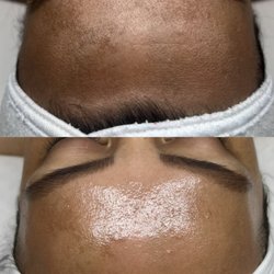 Lueur Skin - Instantly brighter skin