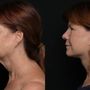 Photo of Revel You Facial Plastic Surgery