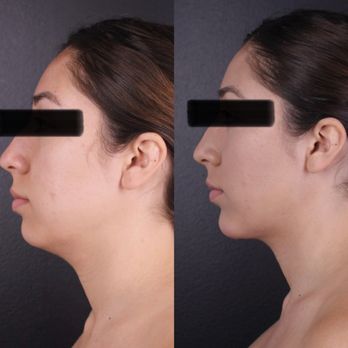Daniel J Gould, MD PhD - Plastic Surgeons Near Me - Beverly Hills, California