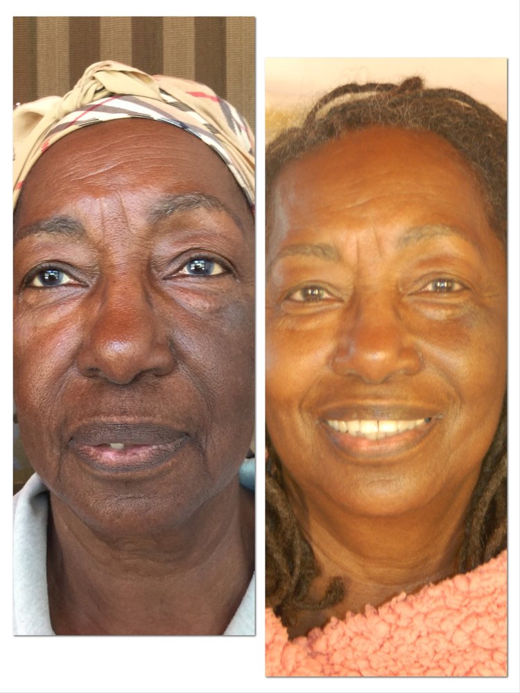 Bloom Facial Rejuvenation Logo