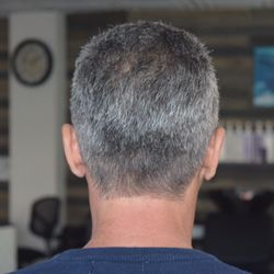 Hairline fade