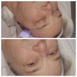 Limitless Skincare & Beauty