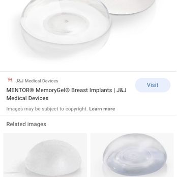 Massachusetts General Hospital Plastic Surgery - This is what was put inside me. - Plastic Surgeons Near Me - Boston, Massachusetts Massachusetts General Hospital Plastic Surgery - This is what was put inside me. - Plastic Surgeons Near Me - Boston, Massachusetts