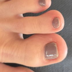 Foxy Nail