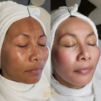 Cindy Moua Permanent Makeup Studio & Academy - Tattoo Removal Near Me - Fresno, California Cindy Moua Permanent Makeup Studio & Academy - Tattoo Removal Near Me - Fresno, California