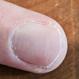 This looks worse AFTER the manicure than before. This looks worse AFTER the manicure than before.