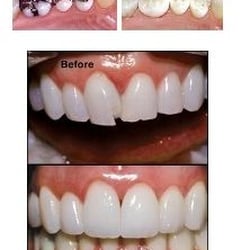 Bright Smiles Family Dentistry