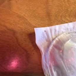 Hair on the napkin Hair on the napkin