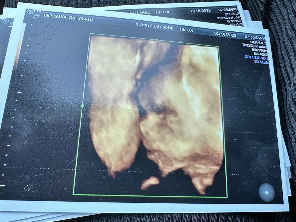 MOMMY AND ME 3D 4D ULTRASOUND - Updated July 2026 - 291 Photos & 580 ...