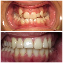 Alexa Alborzi, DDS MDS - Now that is a transformation!!