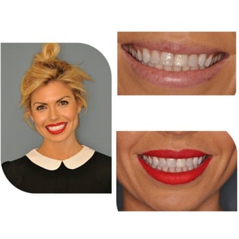 Chirag Patel, DMD - Cosmetic Dentists Near Me - Los Angeles, California Chirag Patel, DMD - Cosmetic Dentists Near Me - Los Angeles, California
