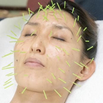 Kang Eastern Medicine Spa - Facial Acupuncture - Massage Therapy Near Me - Pasadena, California Kang Eastern Medicine Spa - Facial Acupuncture - Massage Therapy Near Me - Pasadena, California