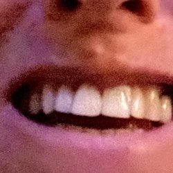 Kay Dental - After