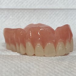 Apex Denture Studio - Complete Upper Denture