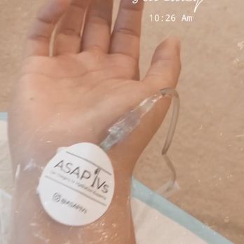 ASAP IVs - Wrist IV - IV Hydration Near Me - La Jolla, California ASAP IVs - Wrist IV - IV Hydration Near Me - La Jolla, California