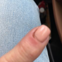 Royal Nail Spa - Not going here again!! Manicure included removing a chunk of skin which now shows signs of infection. No discount, no apology. Never again.