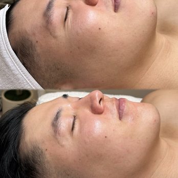 Ambers Esthetic - Anti aging facial V TOX FACIAL - Eyelash Service Near Me Ambers Esthetic - Anti aging facial V TOX FACIAL - Eyelash Service Near Me