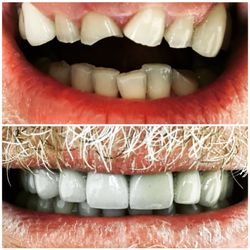 Boulevard Dental