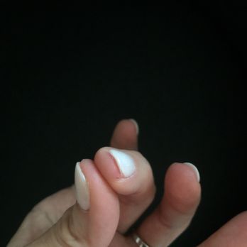 Natural Nail & Spa - I got 2 cuts from this visit, the one on my thumb hurts really bad. This one is on my middle finger. - Nail Salons Near Me - Clifton Park, New York Natural Nail & Spa - I got 2 cuts from this visit, the one on my thumb hurts really bad. This one is on my middle finger. - Nail Salons Near Me - Clifton Park, New York