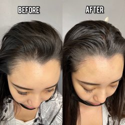 Roger Does SMP - Density treatment