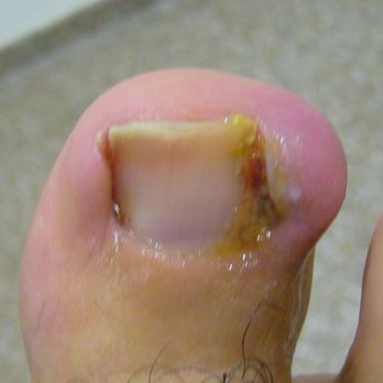 Pedi Care - Podiatrists Near Me - Puerto Vallarta, JAL