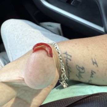 Glow Nail Bar - Shows what I told here was an issue last time that she "fixed" but lasted a week. When I was willing to pay for a fresh new  set - Nail Salons Near Me - Henderson, Nevada