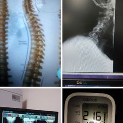 Bish Law - BEWARE.Pics of my damaged cervicalspine and bloodpressure rating. Auto Accident! After year of my life,dropped my case,NO REASON!HEARTLESS!