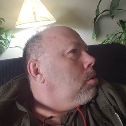 Center for Dermatology and Laser Surgery - A picture of me from cell phone camera.