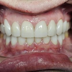 Amazing Dental - Cosmetic case