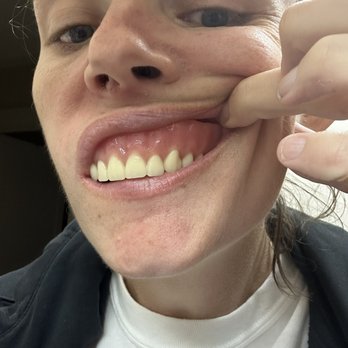 Aspen Dental - Columbia, SC - Harbison - Oral Surgeons Near Me - Columbia, South Carolina Aspen Dental - Columbia, SC - Harbison - Oral Surgeons Near Me - Columbia, South Carolina